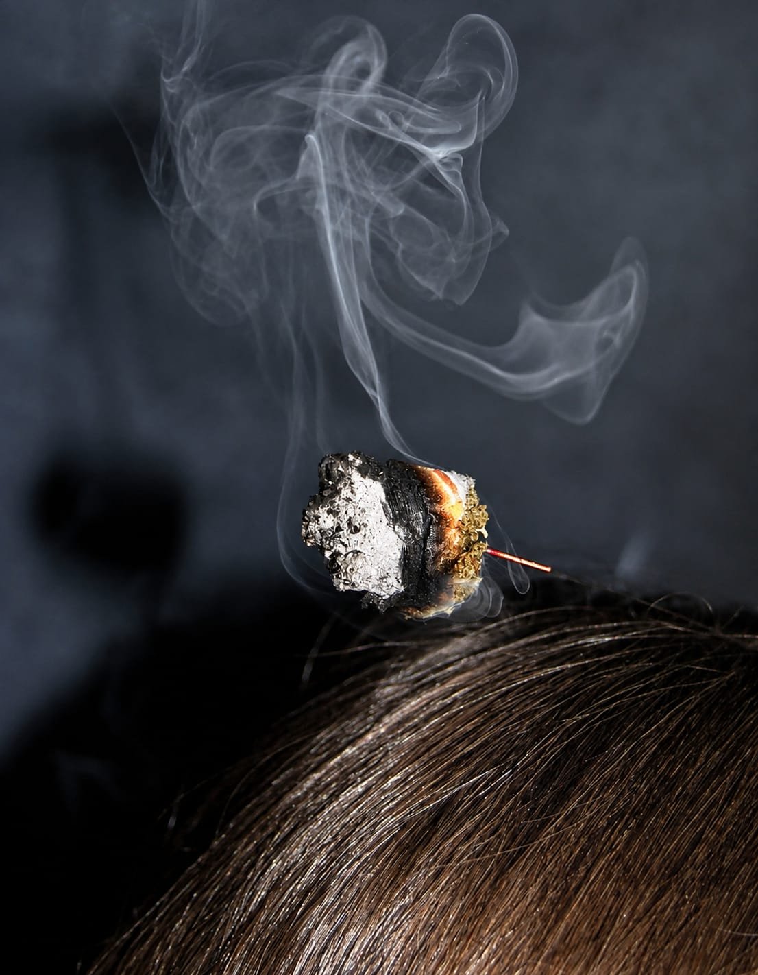 Moxibustion: wärmende Behandlung mit Beifußkraut, Naturheilpraxis Wurster